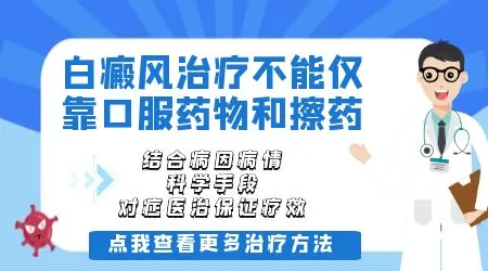 发展期的白癜风只用外用药能控制住吗