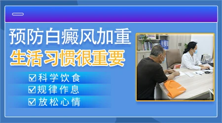 发展期的白癜风只用外用药能控制住吗