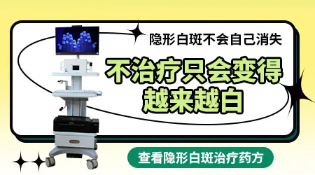 伍德灯下白斑多处出现隐性荧光点是扩散前兆吗