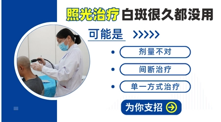 白癜风照光两个月还没恢复正不正常