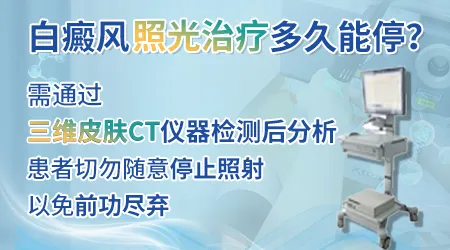 308激光照白癜风到什么程度可以考虑暂停