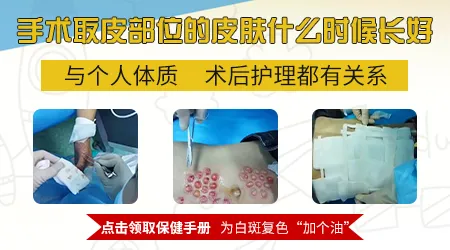 白癜风做表皮移植之后取皮的部位会不会留疤