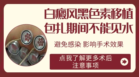 白癜风种植后白斑边缘发黑是好转了吗