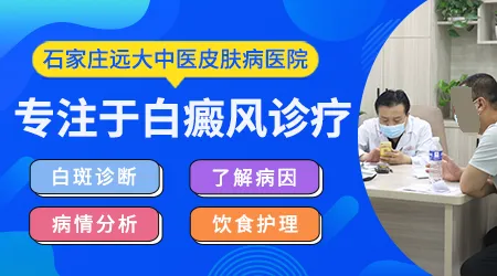 白癜风普通门诊和专科门诊收费差别大吗