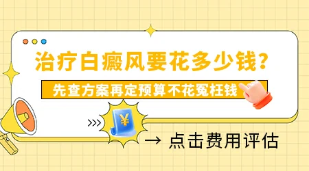 白癜风普通门诊和专科门诊收费差别大吗
