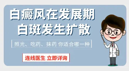 伍德灯检查能看出白斑处于什么阶段吗