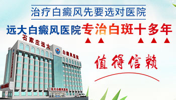 邯郸有没有只治白癜风的医院