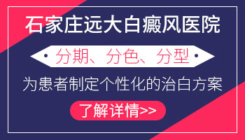 邯郸治白癜风去哪家医院好