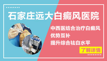 邯郸检测白癜风医院哪家好