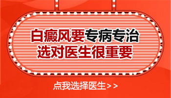 河北邯郸治疗白癜风专家哪个好