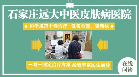 石家庄专治白斑病医院