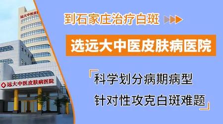 石家庄市皮肤病医院哪家好 石家庄专治皮肤白斑