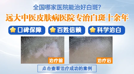 石家庄最好的皮肤病医院是哪家