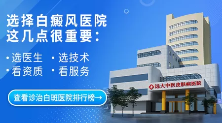 治疗白癜风比较好的医院