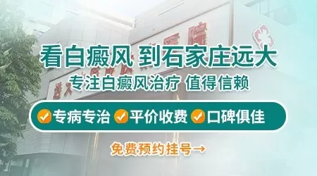 石家庄哪几家医院能治好白癜风