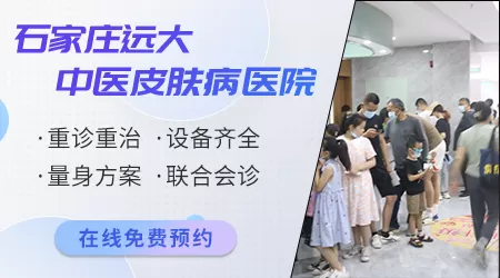 石家庄市看白斑病比较好的医院