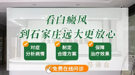 石家庄治疗白斑比较好的医院