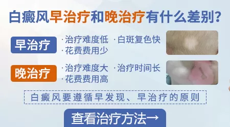 石家庄治疗白斑比较好的医院