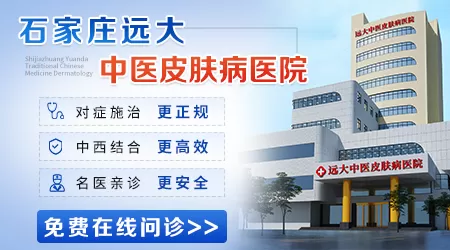 石家庄远大医院治白癜风多少钱