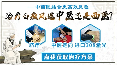 邯郸哪家医院专业治疗白癜风