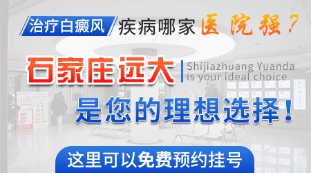 邯郸哪个医院治白癜风最好