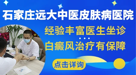 邯郸治疗白癜风有名的医生