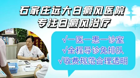邯郸有哪些白癜风专科医院