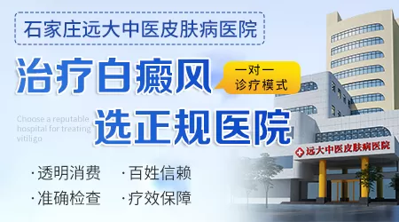 邯郸哪家医院治疗白癜风有名