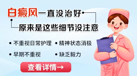 邯郸哪家医院擅长治白癜风