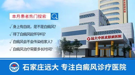 邯郸哪家医院看皮肤白斑好