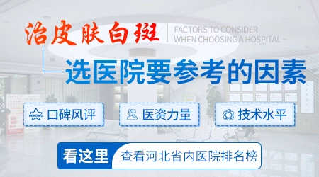 邯郸白癜风医院哪家治疗效果好