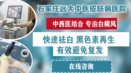 邯郸哪家医院中西医结合治白癜风