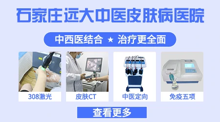 中西医结合治疗白癜风的医院邯郸哪家好