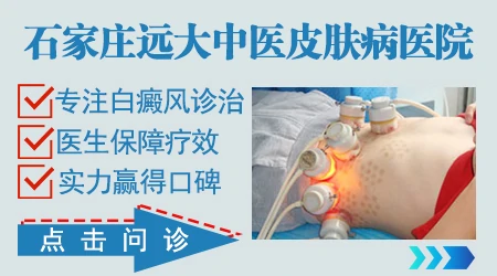 邯郸治疗白癜风评价好的医院
