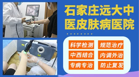 邯郸白斑最好的医院