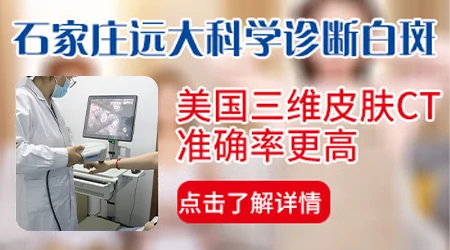 邯郸哪个医院能做皮肤CT检测