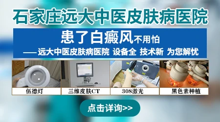 邯郸预约哪个专家看白癜风好