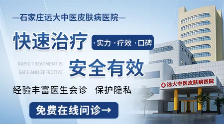 邯郸哪家医院治疗白斑最好