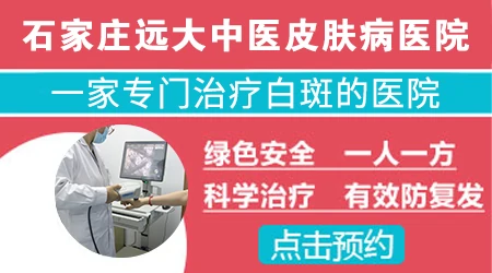 邯郸有没有专门看白癜风的医院