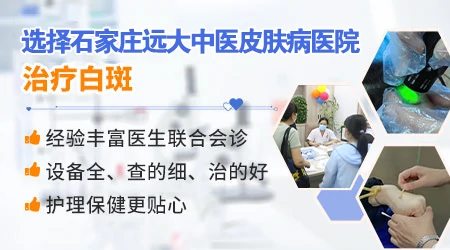 邯郸有没有治疗白癜风好的专科医院