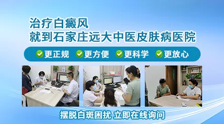 邯郸看白癜风到哪个医院好