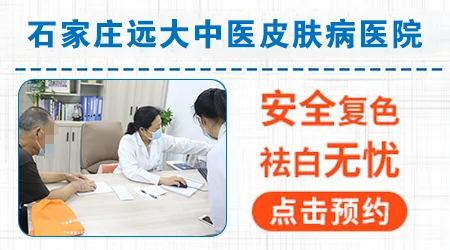 邯郸哪家医院治疗白癜风治愈率高