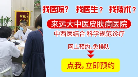 邯郸哪家医院治疗白癜风治愈率高