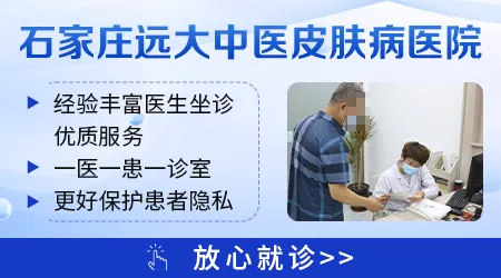 邯郸白癜风黑色素移植哪家医院好