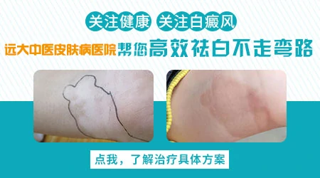 邯郸哪个医院皮肤科治白斑好
