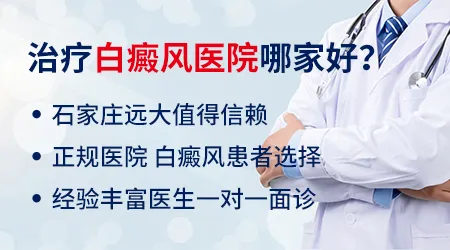 邯郸有没有白癜风专科医院