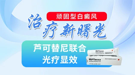 芦可替尼联合308nm光疗治疗白癜风的效果