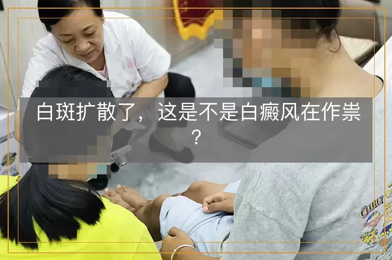 白斑扩散了，这是不是白癜风在作祟？