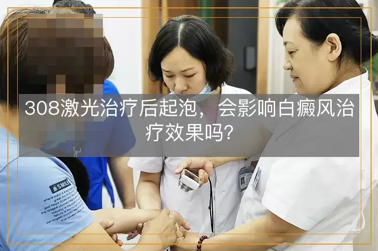 308激光治疗后起泡，会影响白癜风治疗效果吗？