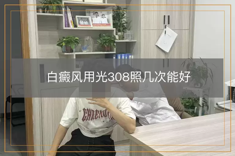 白癜风用光308照几次能好